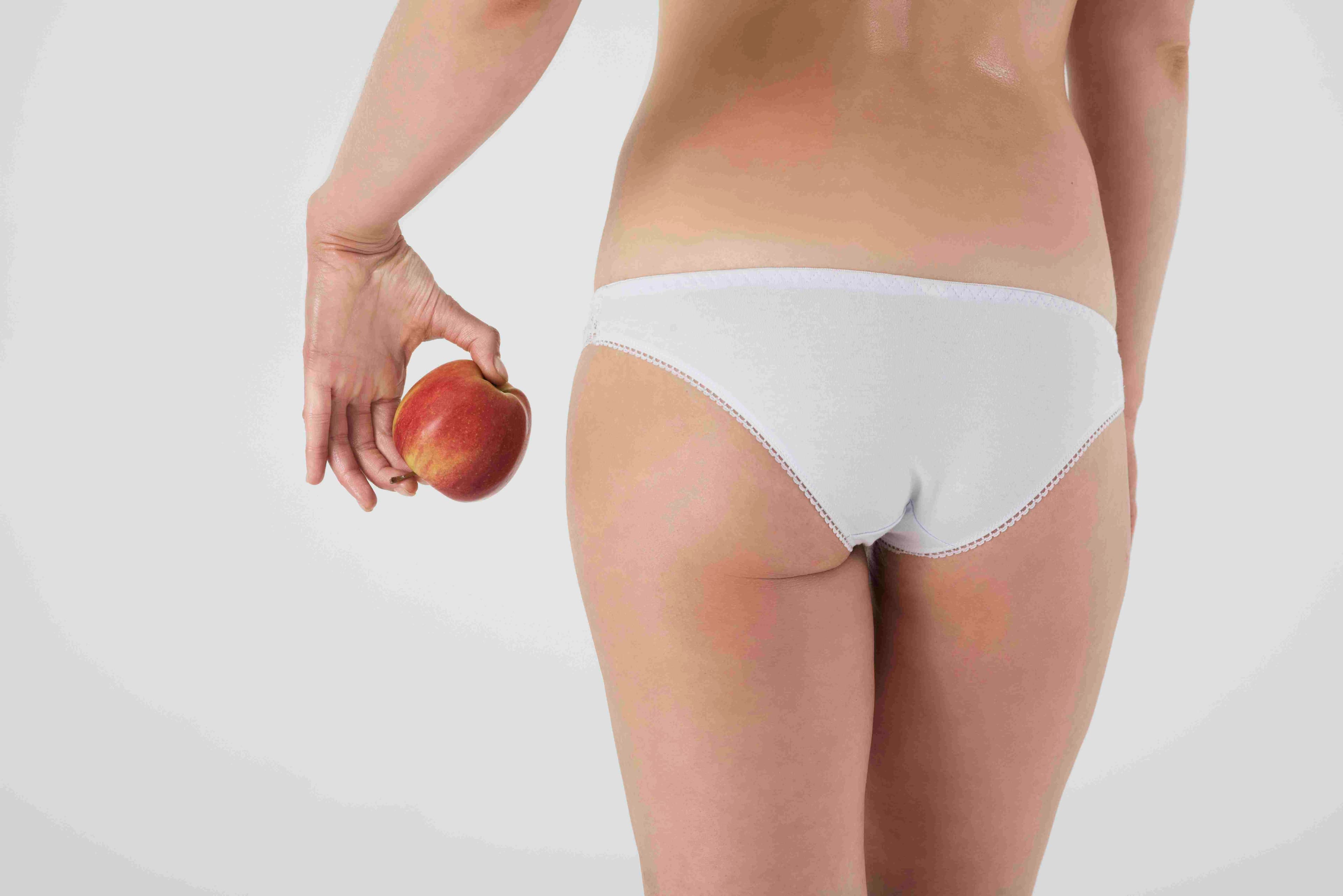 Lipofilling des fesses