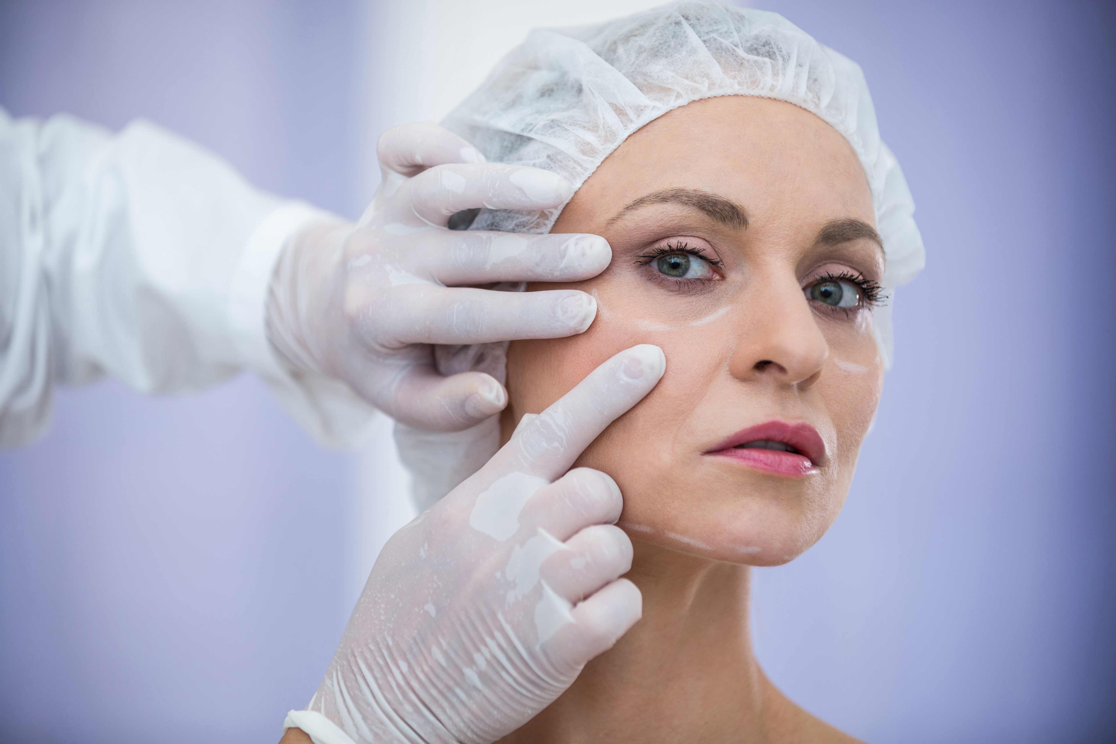 Blépharoplastie