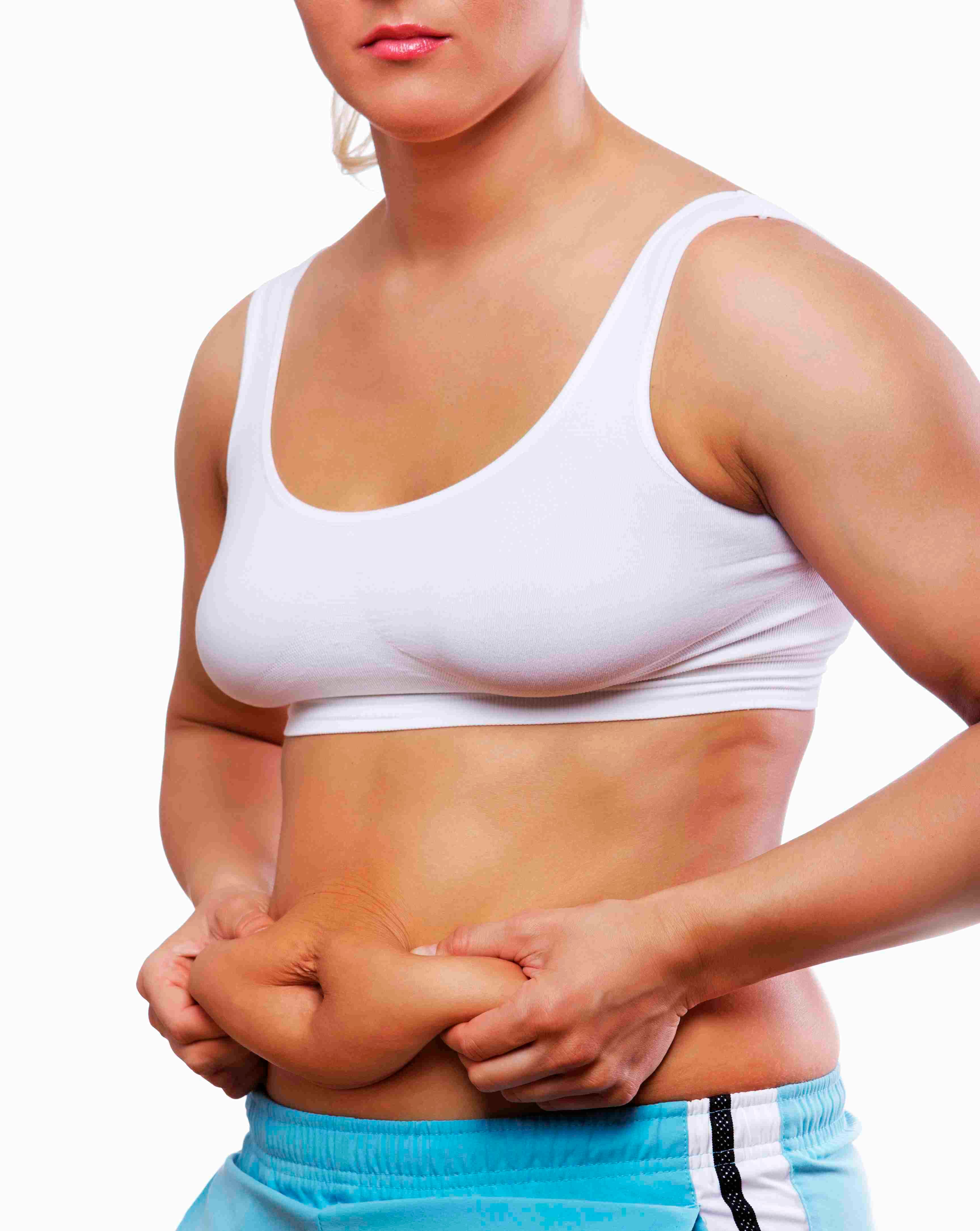 Abdominoplastie avec liposuccion complète