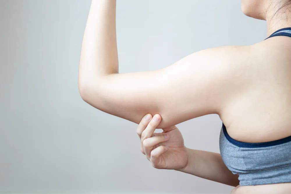 Lifting des bras - Brachioplastie
