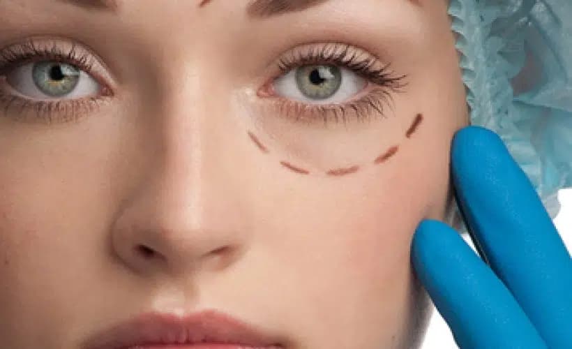 Lipofilling visage
