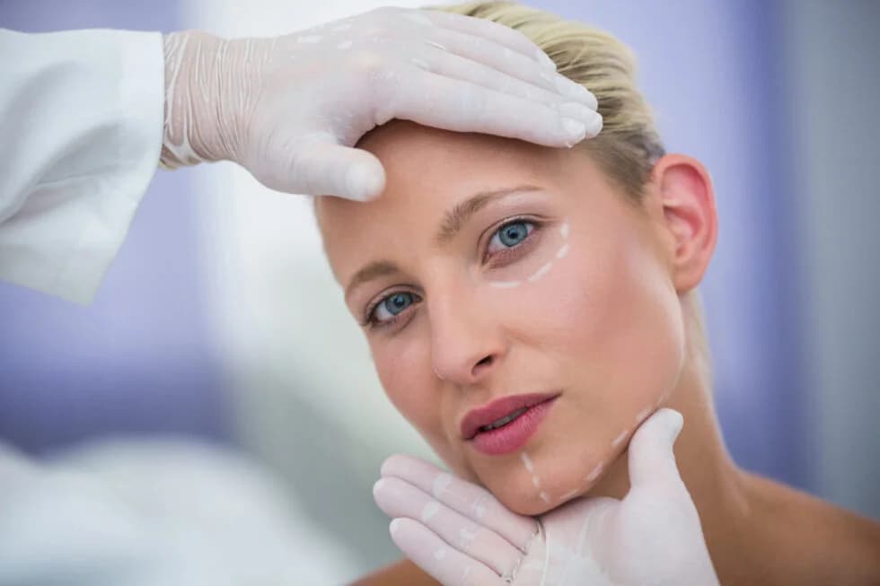 Lifting de visage et fils tenseurs