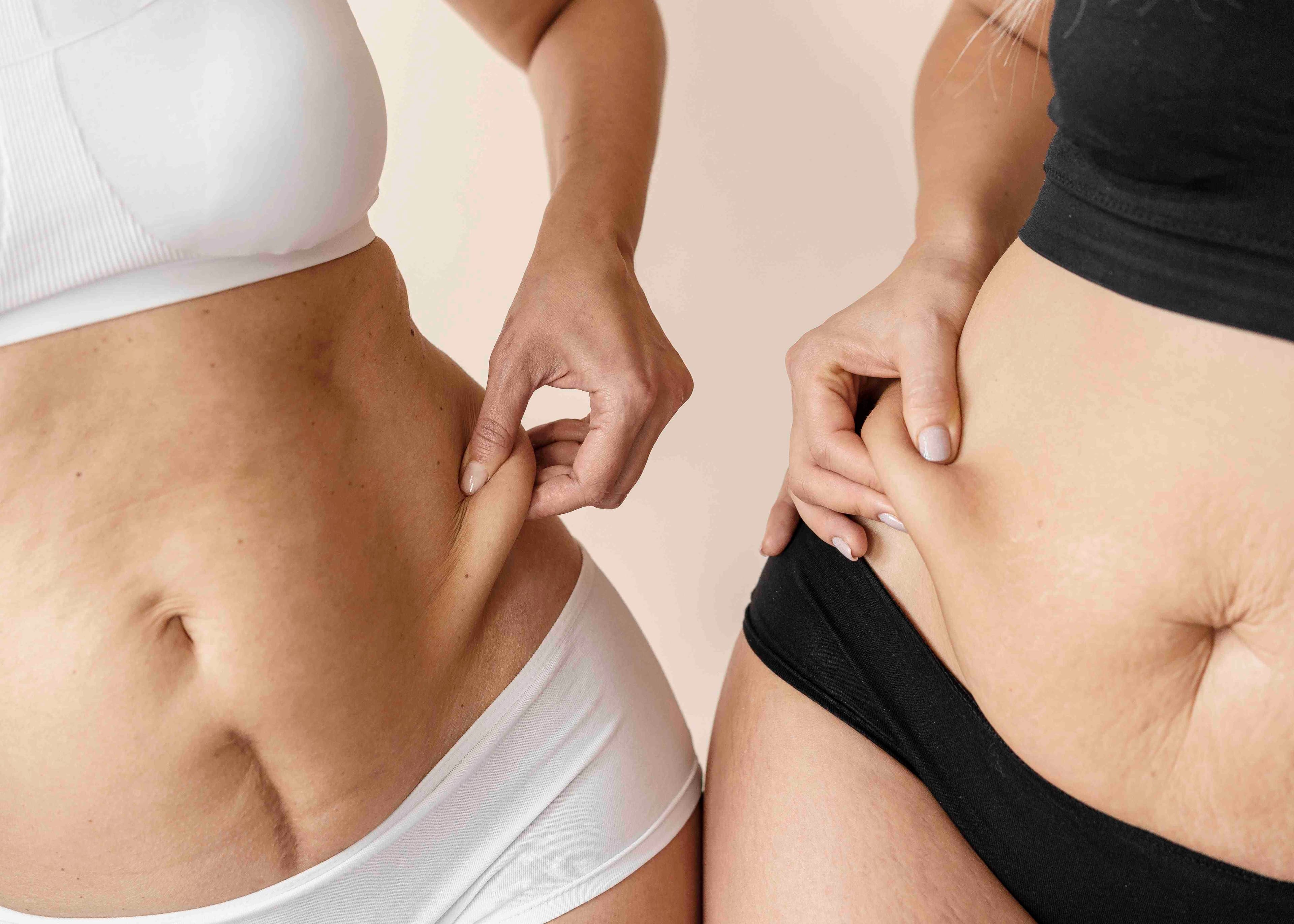 Opérations de liposuccion