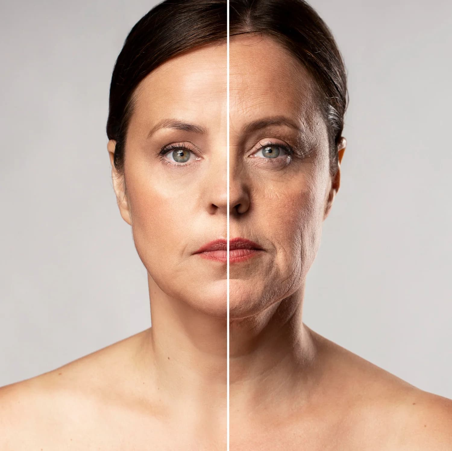 Lifting cervico facial