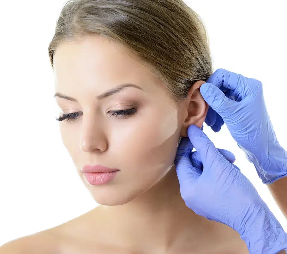 Otoplastie