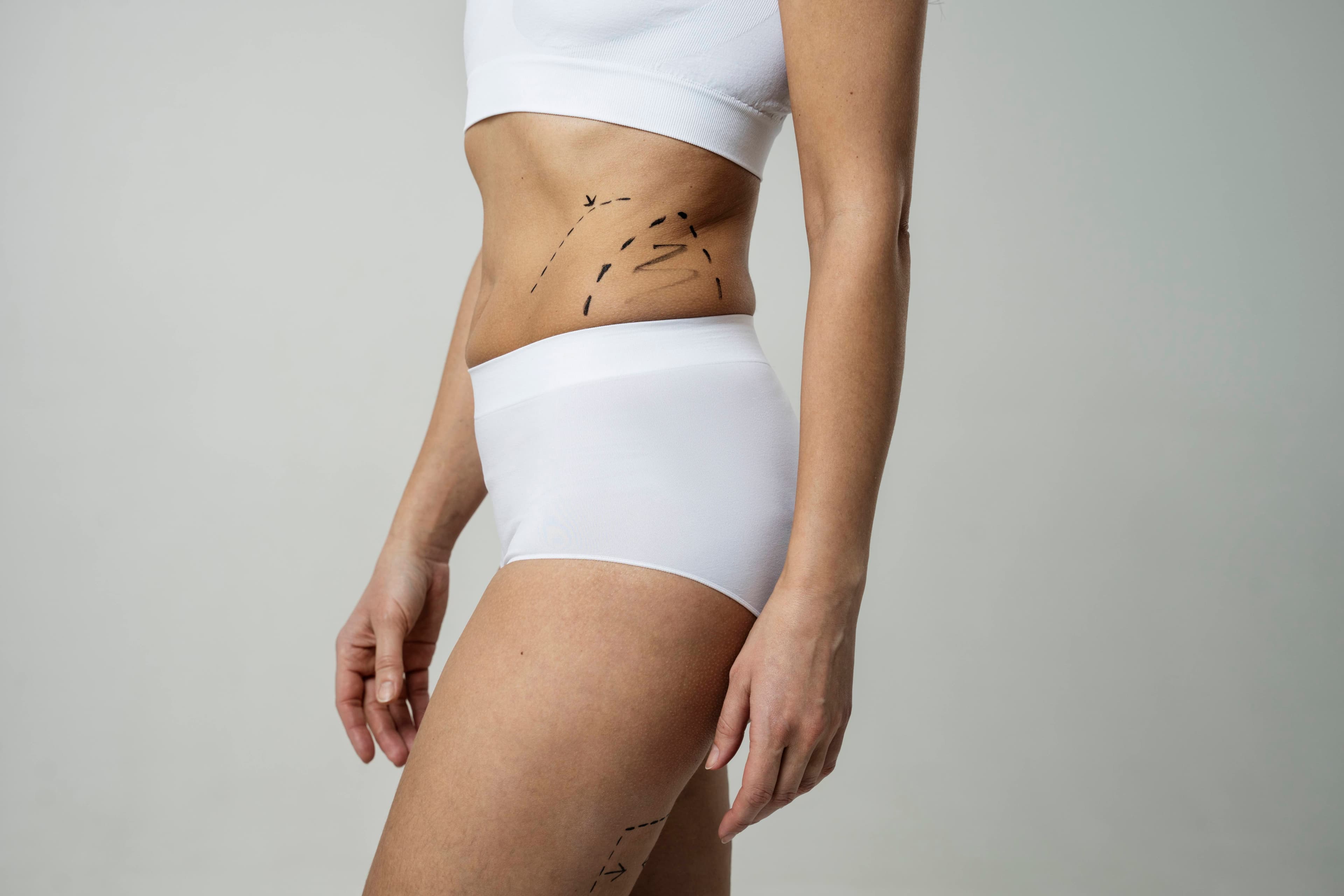 Opérations de lipofilling