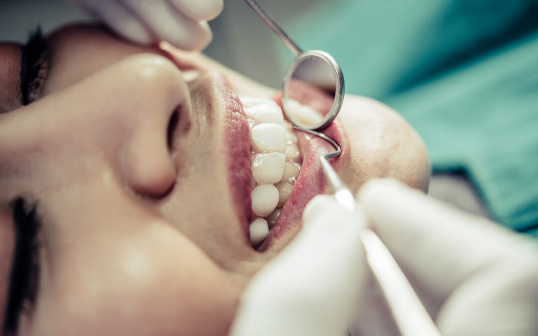 Chirurgie dentaire en Tunisie